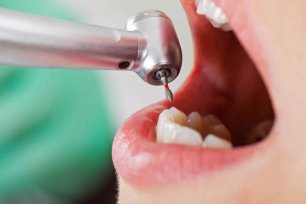 Best Emergency Dental Care for Trauma or Injury in Minerva Park, OH